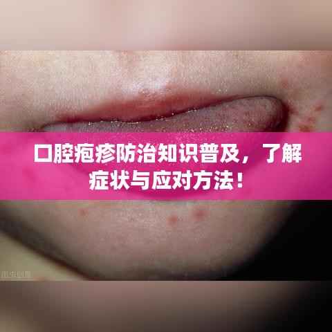 口腔疱疹防治知识普及,了解症状与应对方法!