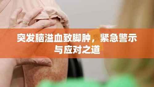 突发脑溢血致脚肿,紧急警示与应对之道