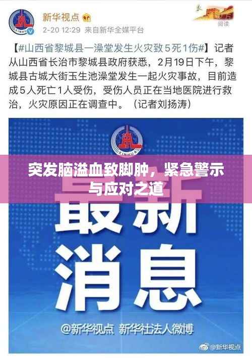 突发脑溢血致脚肿,紧急警示与应对之道