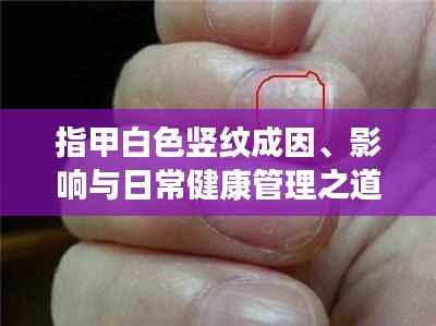 指甲白色竖纹成因、影响与日常健康管理之道